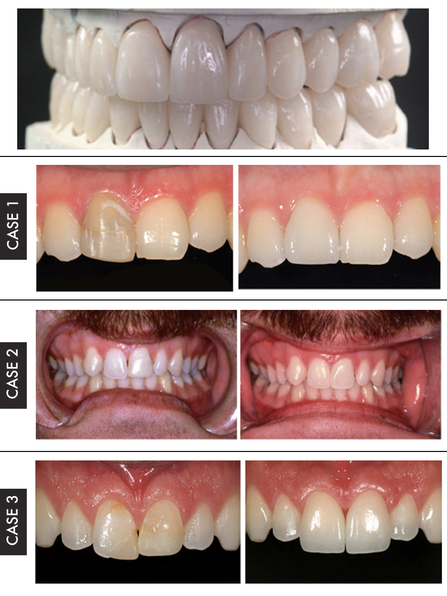 Authentic Dental Laboratory | Restorations