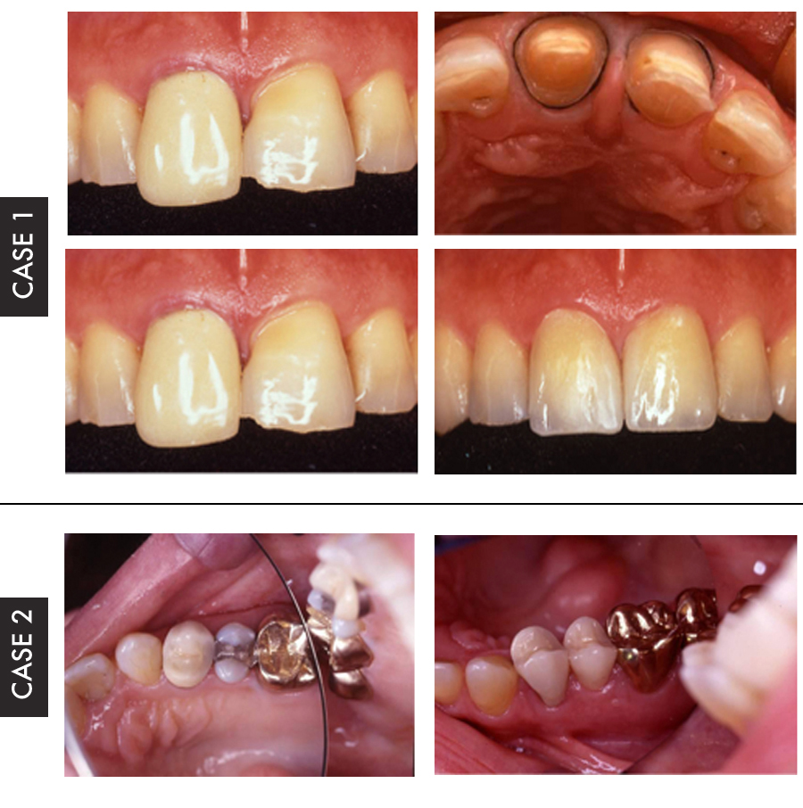 Authentic Dental Laboratory | Restorations